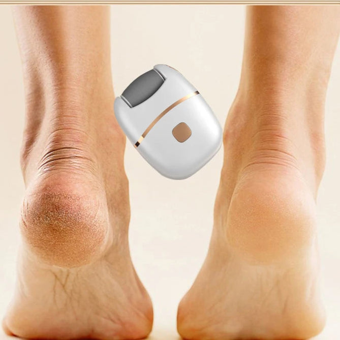 SoftFeet – פדיקור חשמלי מקצועי בבית